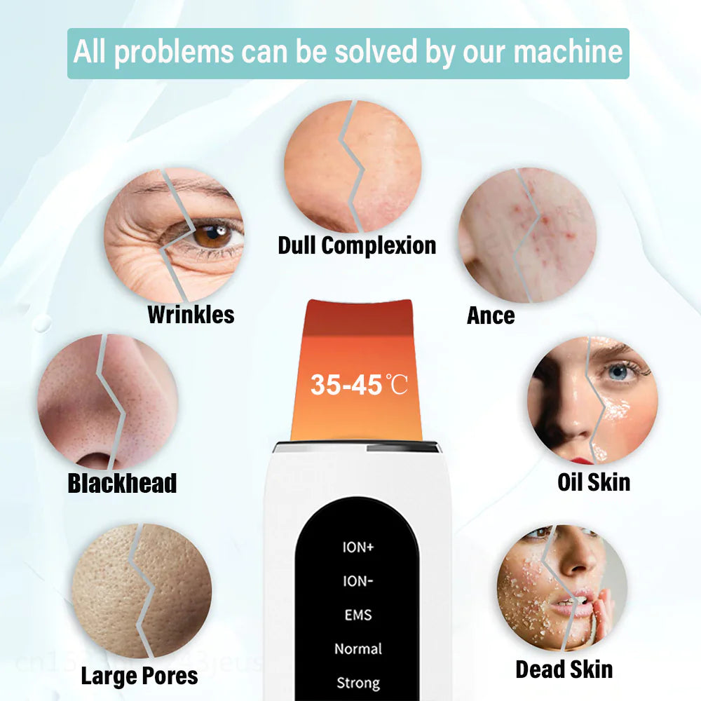 Ultrasonic Skin Scrubber – Facial Blackhead Remover & Pore Cleaner