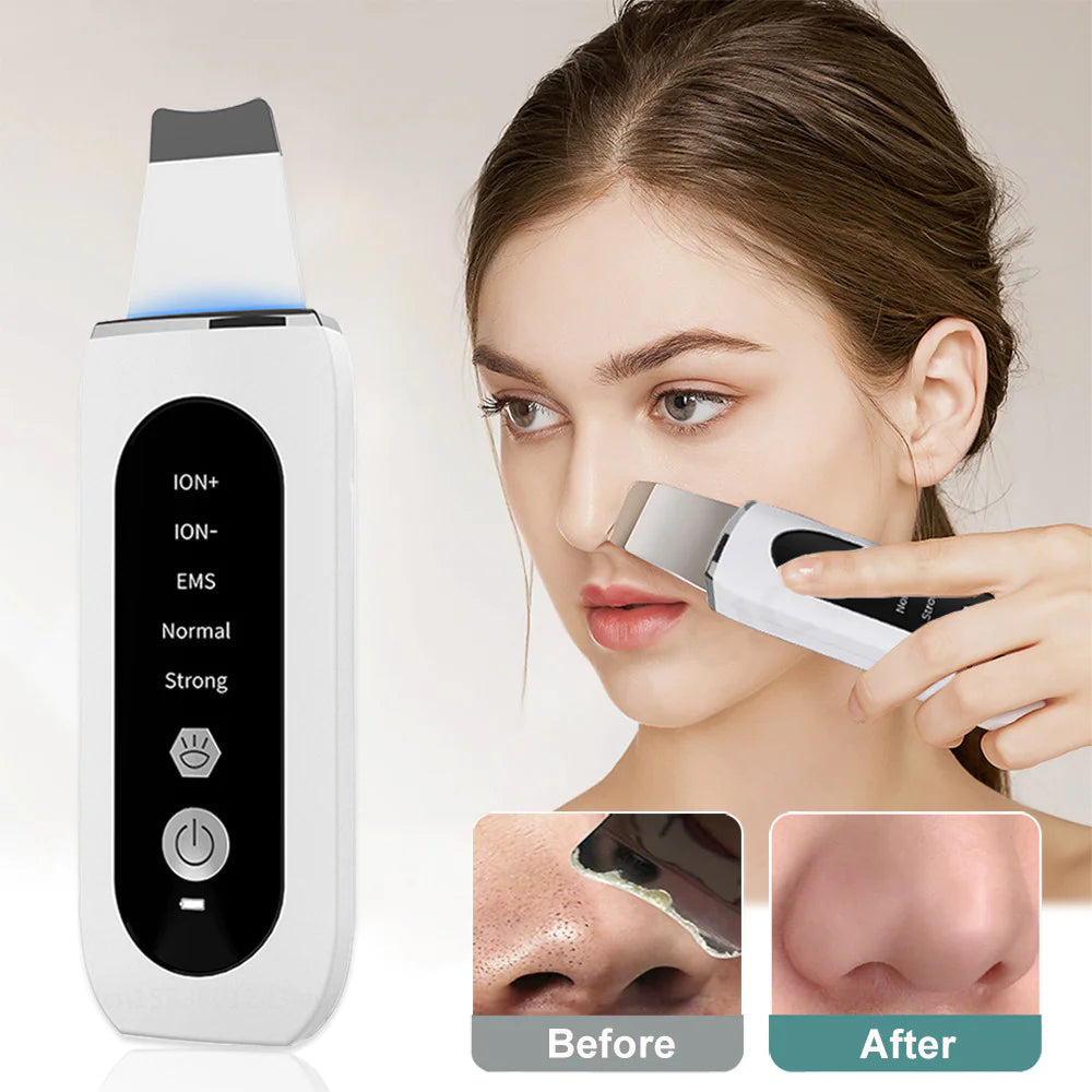Ultrasonic Skin Scrubber – Facial Blackhead Remover & Pore Cleaner